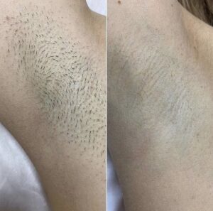 Before&After